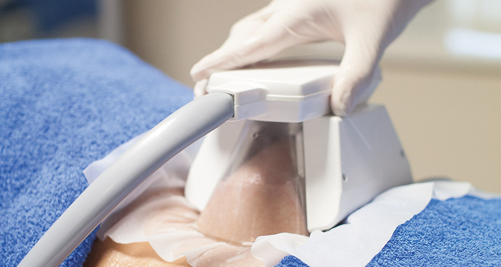 How Fat Freezing and HIFU Work Together? 2 Multiple Areas in One Session HIFU and Fat Freezing Oxted